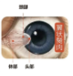 【科普】得了翼状胬肉，要切掉吗？